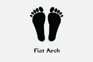 tips pilih sepatu untuk bentuk kaki flat arch