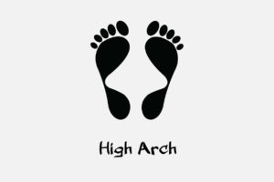 tips pilih sepatu untuk bentuk kaki high arch