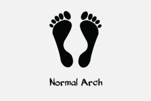 tips pilih sepatu untuk bentuk kaki normal arch