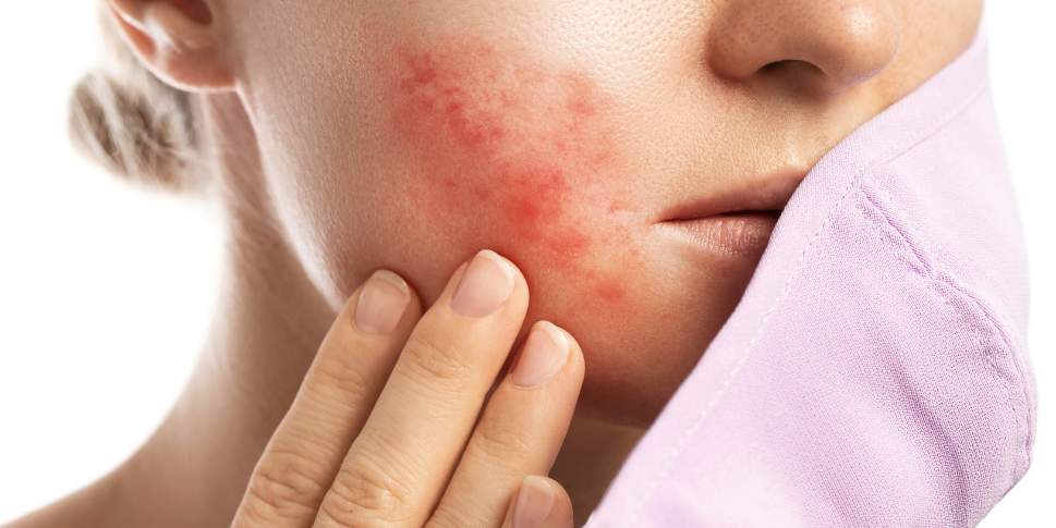 Skincare Palsu