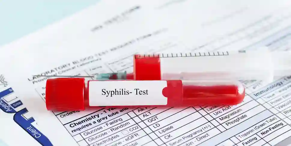 Berbagai jenis penyakit kelamin bisa mengancam kita, termasuk penyakit sifilis. Dengan mengetahuinya, kita bisa mengurangi risikonya lho.