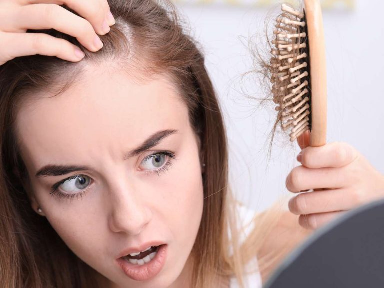 Siapa sih yang kepingin punya masalah kulit kepala? Enggak dong. Nah Majalah Sunday mau share jenis dan solusinya buat kamu! | rambut uban