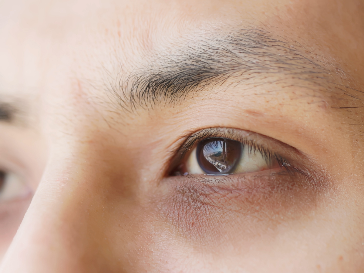 Mata panda bikin nggak pede