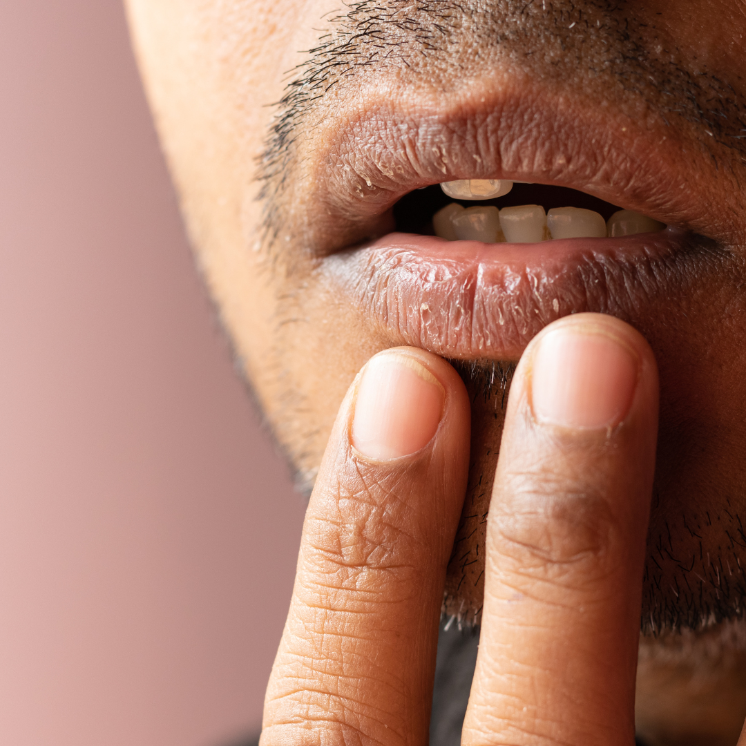 Ini tips mencerahkan bibir hitam