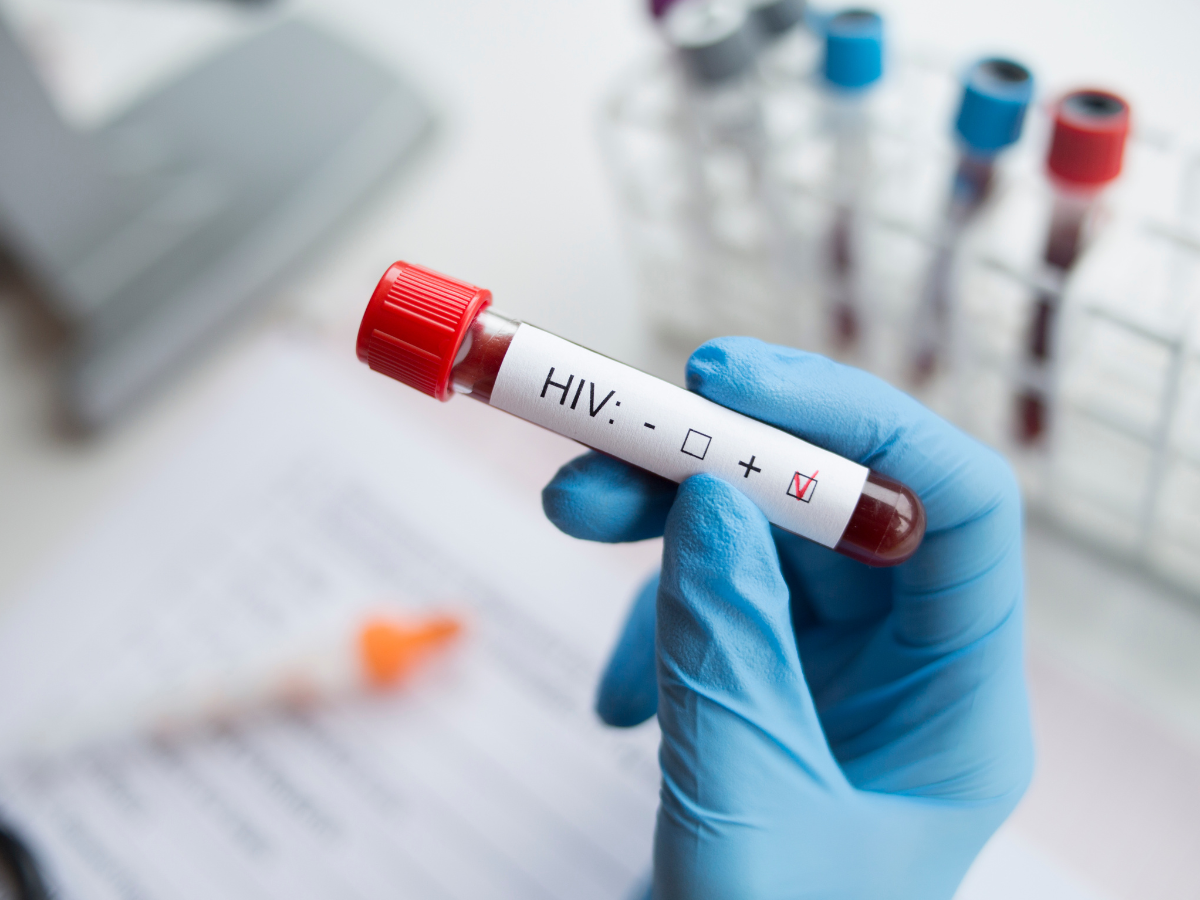 HIV dan AIDS ternyata dua hal yang berbeda