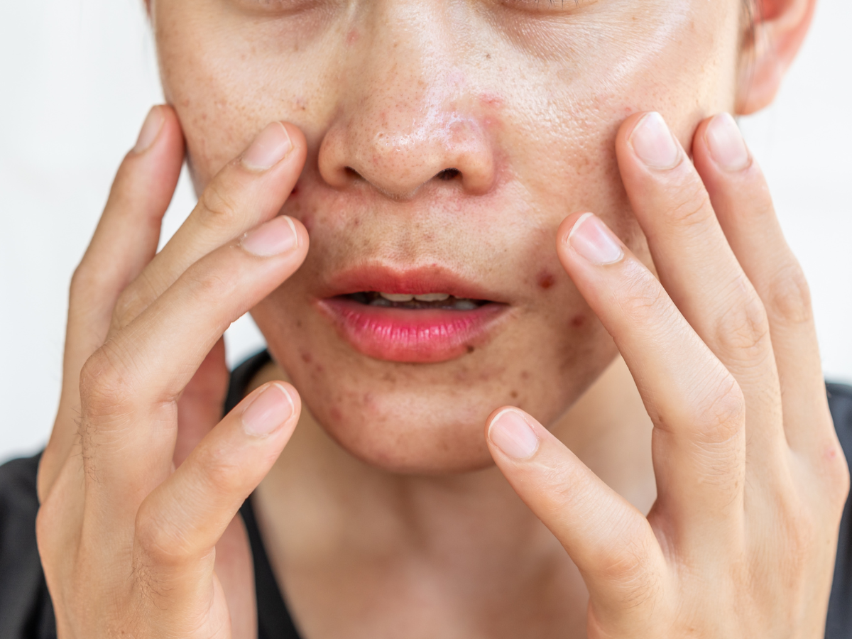 Tips Pilih Skincare untuk Kulit Sensitif