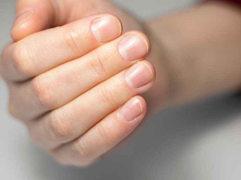 Merawat kuku saat ini sangat penting untuk kesehatan dan penampilan. Simak ciri-ciri kuku serta tips memiliki kuku indah tanpa perlu mahal.